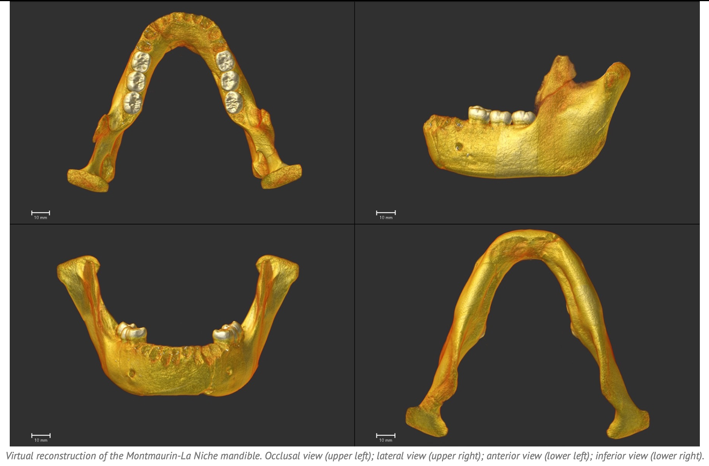 Virtual reconstruction of the Montmaurin-La Niche mandible. Occlusal view (upper left); lateral view (upper right); anterior view (lower left); inferior view (lower right).  
